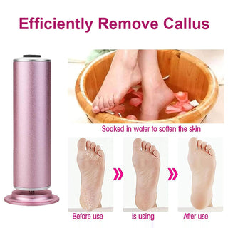 SAKER Electric Callus Remover